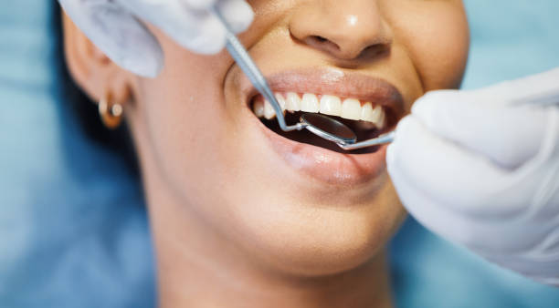 Best Urgent Care for Lost Fillings or Crowns in Mayfair, CA